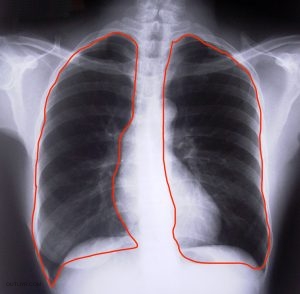 The bottom of the lungs holds more air.