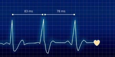 HRV vs HR